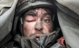 俄战争英雄涉嫌伪造伤情事件曝光