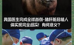 重庆实现首例成人亲体辅助肝移植成功