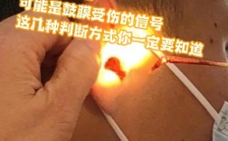 爸爸掏耳朵意外受伤，孩子不慎撞落耳膜