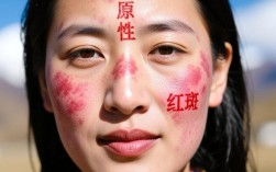 高原红肌肤的消除攻略