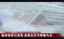 佛山现基孔肯雅热疫情，新增确诊病例52例