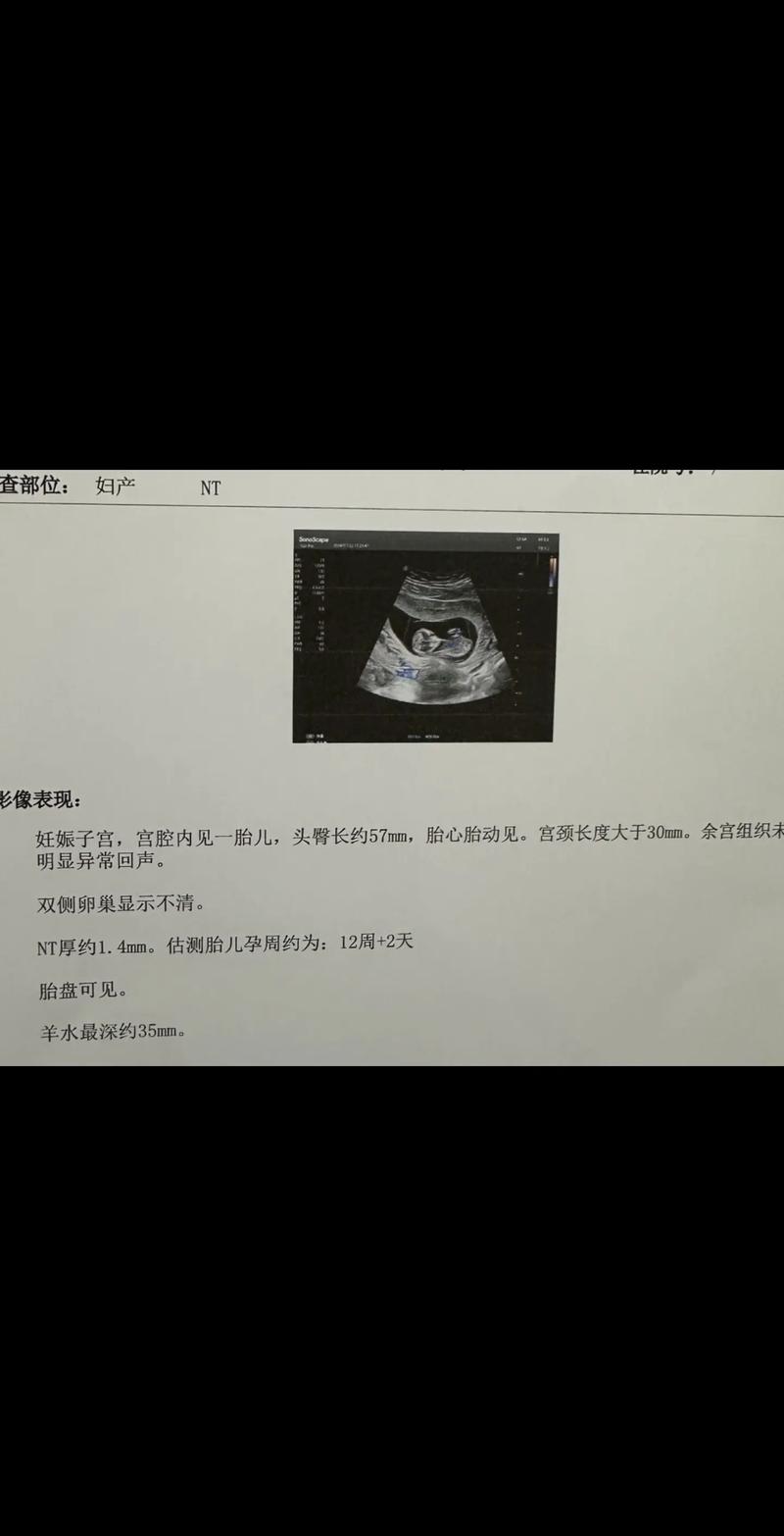 NTP报错，如何快速定位并解决网络时间协议错误？-图2