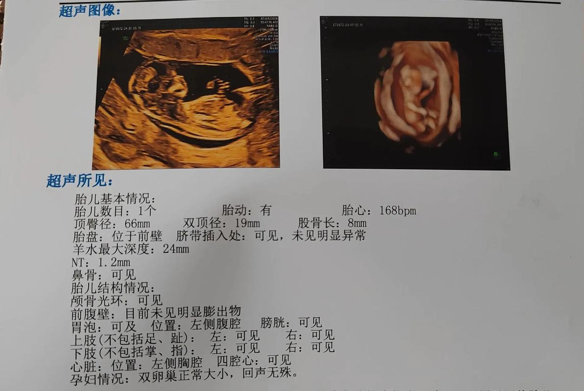 NTP报错，如何快速定位并解决网络时间协议错误？-图3