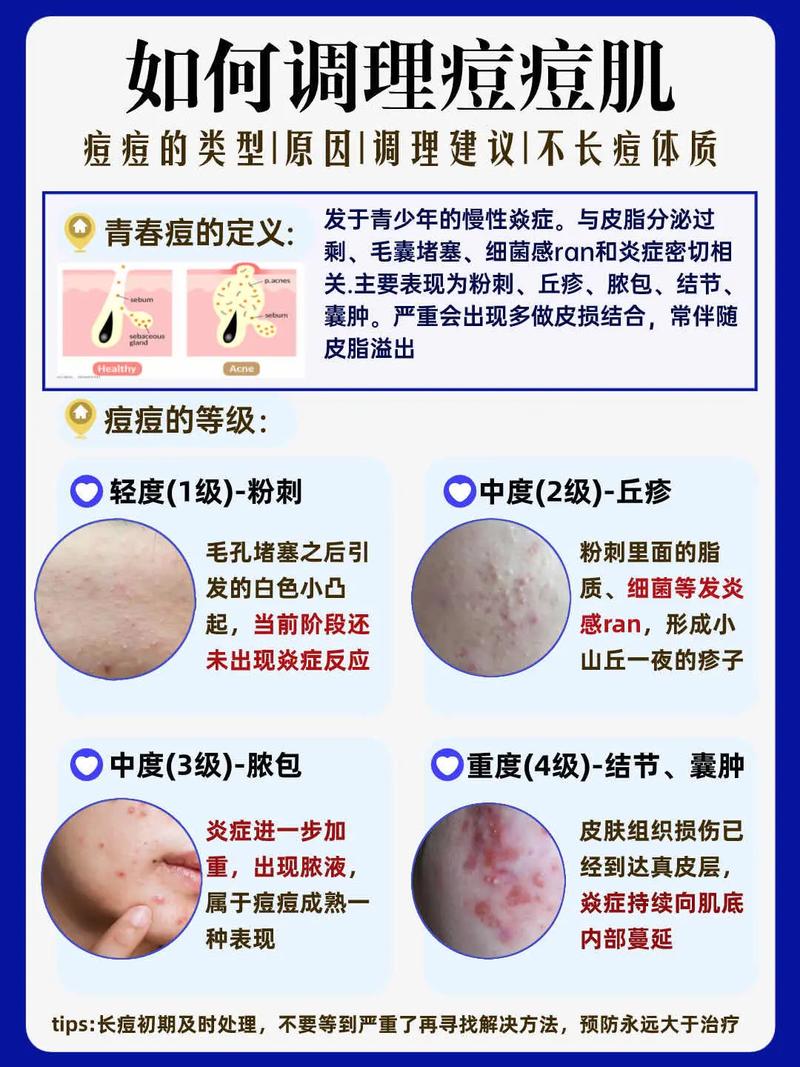 一招告别痘痘，专业PS去痘教程大公开-图2