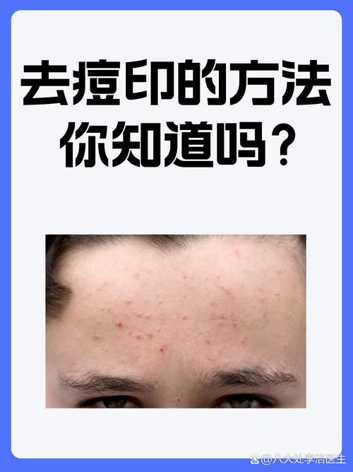 一招告别痘痘，专业PS去痘教程大公开-图3