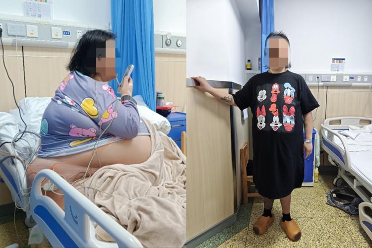 胃萎缩女孩体重骤减近60斤,从90多斤跌至35斤-图3 胃萎缩女孩体重骤减近60斤,从90多斤跌至35斤-图3