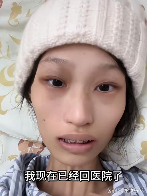抗癌网红雯仔离世,985高校才女勇战病魔两年终告别人世-图3 抗癌网红雯仔离世,985高校才女勇战病魔两年终告别人世-图3