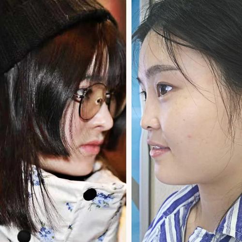 青少年医美热现象，家长需警惕与引导并重-图2