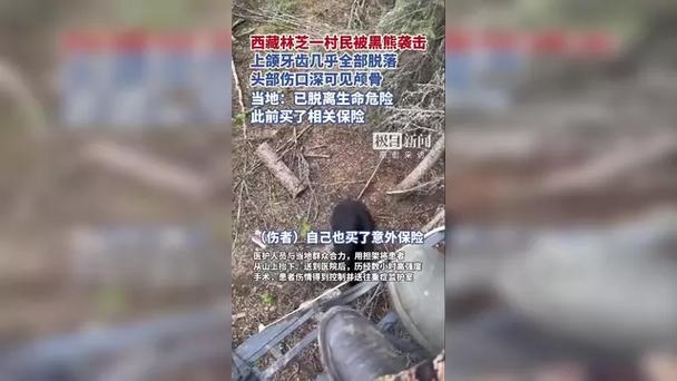 林芝村民遭遇黑熊袭击,官方回应情况详情-图1 林芝村民遭遇黑熊袭击,官方回应情况详情-图1