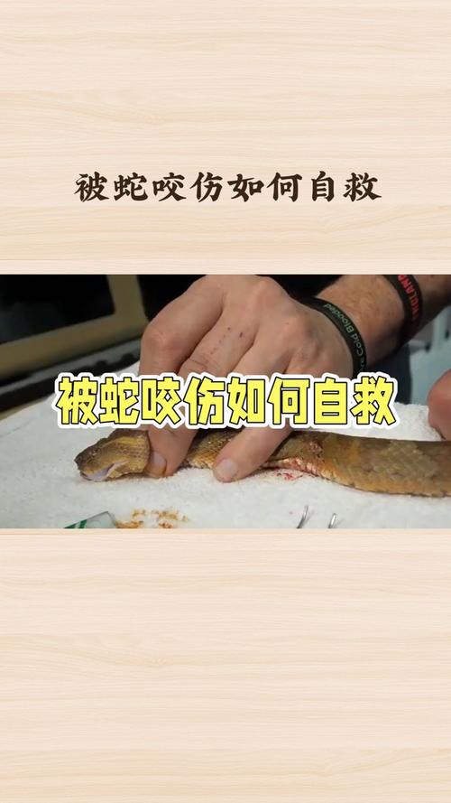 紧急自救，被蛇咬后能否用嘴吸出毒血？-图1