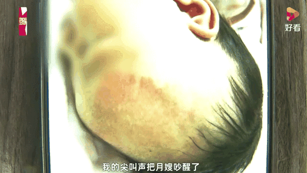 月嫂疏忽婴儿重摔致颅内出血事件引发关注-图2 月嫂疏忽婴儿重摔致颅内出血事件引发关注-图2