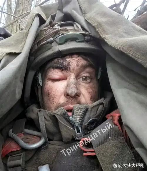 俄战争英雄涉嫌伪造伤情事件曝光-图1 俄战争英雄涉嫌伪造伤情事件曝光-图1