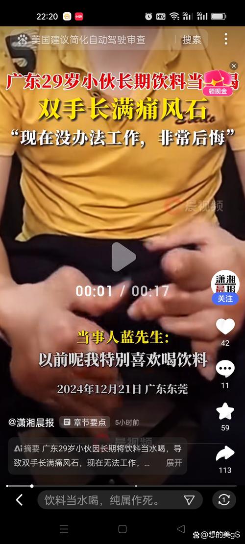 火锅汤成痛风陷阱，小伙豪饮后痛不欲生-图1