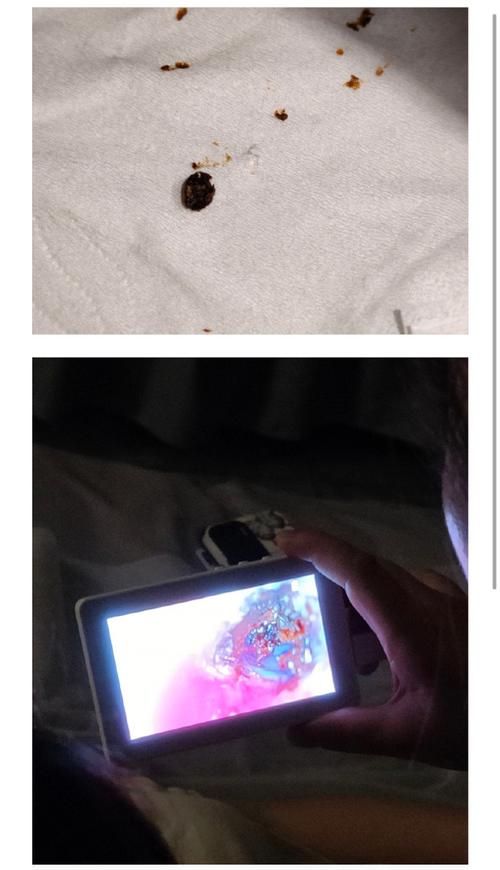 爸爸掏耳朵意外受伤,孩子不慎撞落耳膜-图3 爸爸掏耳朵意外受伤,孩子不慎撞落耳膜-图3