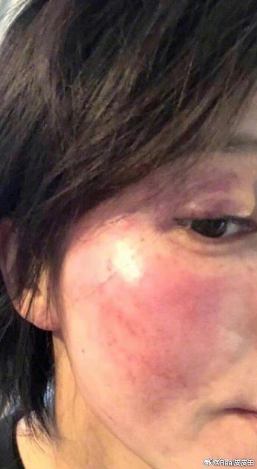黄景瑜前妻爆料，孩子被打丢真相曝光-图2