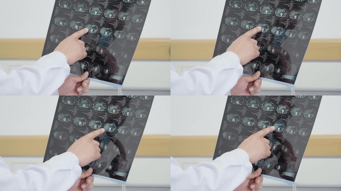 医生风采,视频剪辑技巧解析-图2 医生风采,视频剪辑技巧解析-图2