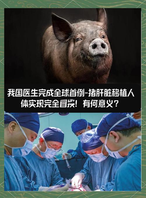 重庆实现首例成人亲体辅助肝移植成功-图1