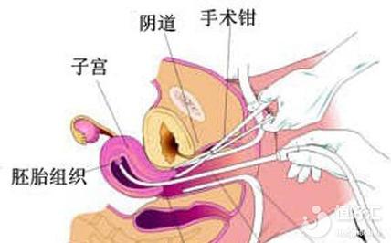 试管婴儿患肾病引纠纷,父母索医院全责-图2 试管婴儿患肾病引纠纷,父母索医院全责-图2