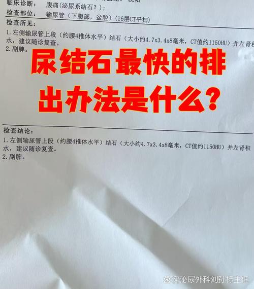 肾结石忽视成隐患，男子健康状况急转直下-图3