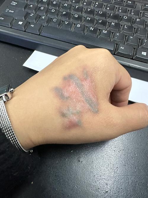 纹面男孩期待洗纹身，两次清洗将洗净印记-图3